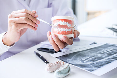 Dentures at West Park Dental