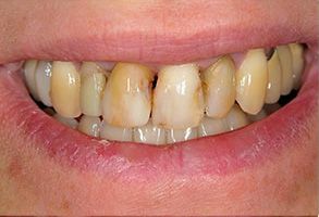 Smile Gallery - Before