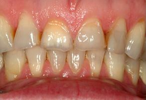 Smile Gallery - Before