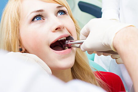 Extractions at West Park Dental
