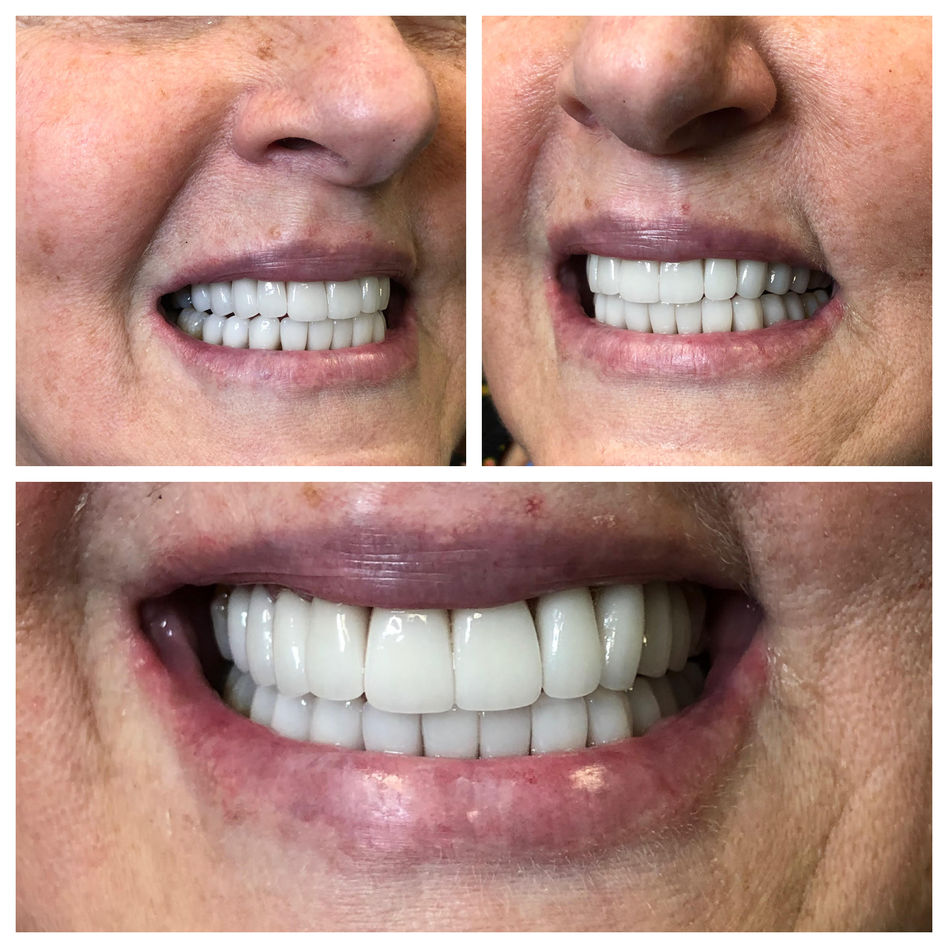 Before and After Image
