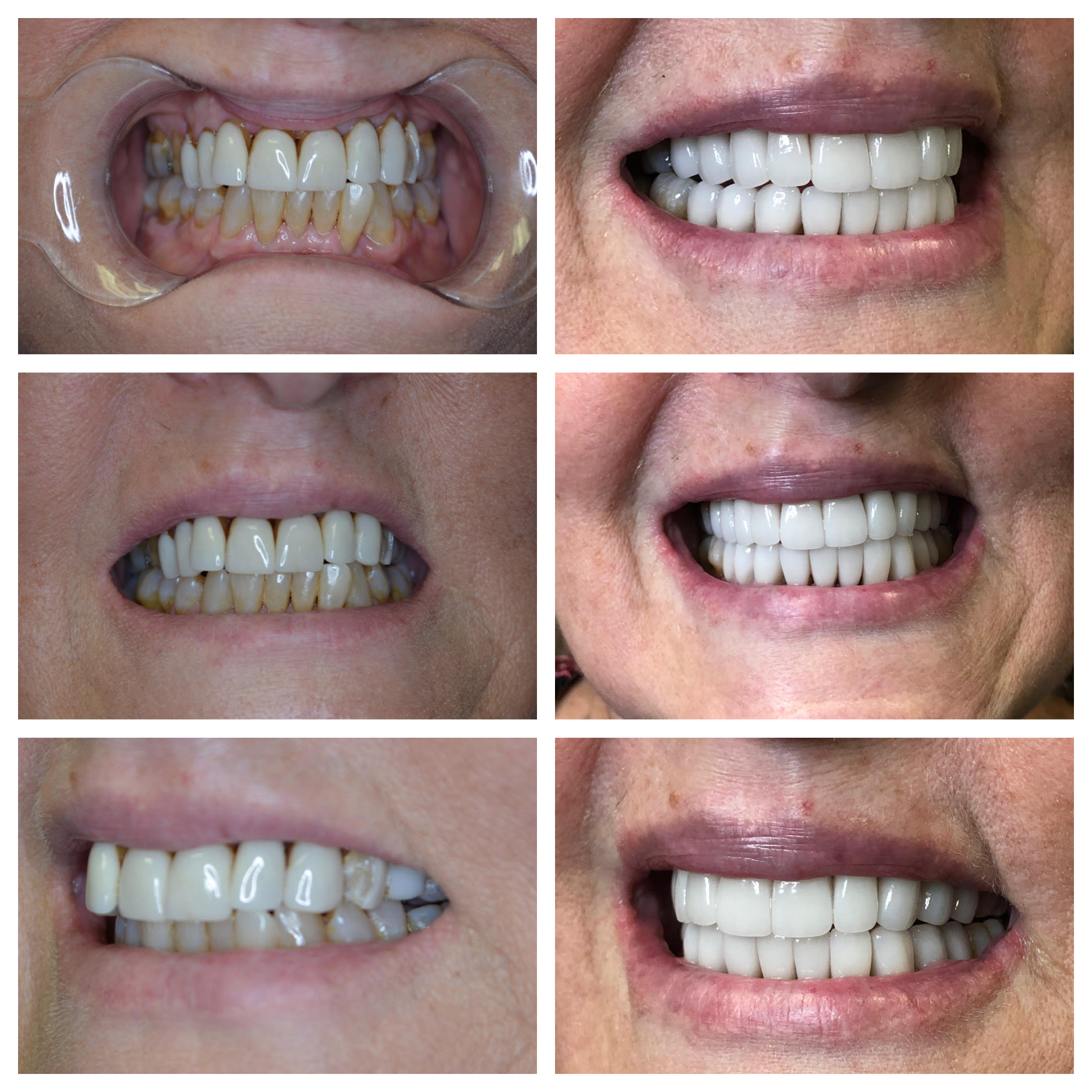 Before and After Image